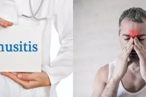 15 Penyebab sinusitis, gejala, dan cara mengobati secara alami