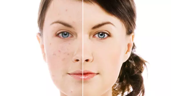 air kelapa untuk kesehatan © berbagai sumber air kelapa untuk kesehatan © berbagai sumber