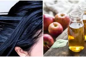 7 Cara mengatasi rambut berminyak, aman dan antilepek
