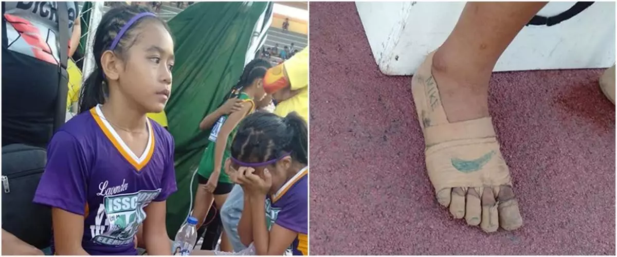 Bocah ini lomba lari nyeker kakinya diperban, bisa sabet 3 medali