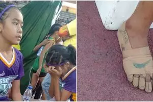 Bocah ini lomba lari nyeker kakinya diperban, bisa sabet 3 medali