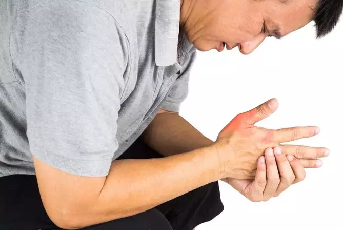 Penyebab asam urat di tangan Istimewa