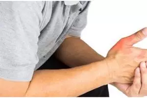 Penyebab asam urat di tangan dan cara mengatasinya