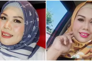 Sering dihina, ini 7 potret terbaru Elly Sugigi usai potong gigi