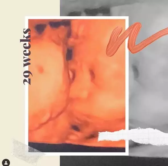 Tantri Kotak unggah foto USG buah hatinya, warganet salah fokus © 2019 brilio.net