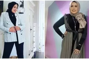 5 Perawatan kecantikan Elly Sugigi demi ubah penampilan