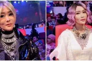 Pose di depan garasi, koleksi mobil mewah Inul jadi sorotan