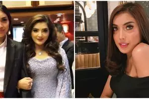 5 Tanggapan Ashanty tentang perubahan fisik Millendaru