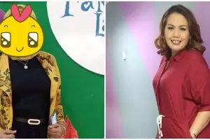 8 Beda penampilan Elly Sugigi sebelum vs sesudah potong gigi