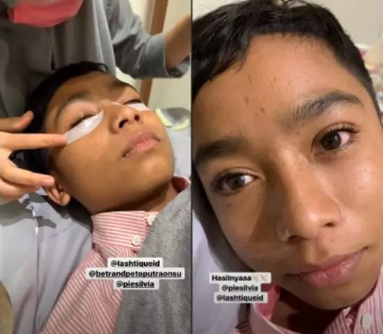 betrand peto perawatan © 2019 brilio.net betrand peto perawatan © 2019 brilio.net