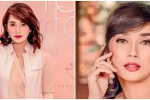 7 Potret perubahan wajah Ussy Sulistiawaty yang akui tanam benang