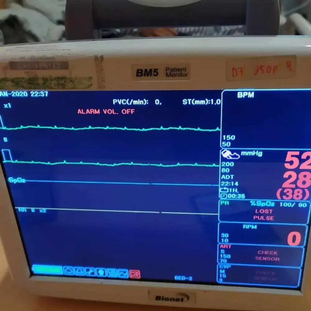Cerita Melly Goeslaw detik-detik Ria Irawan meninggal instagram Cerita Melly Goeslaw detik-detik Ria Irawan meninggal instagram