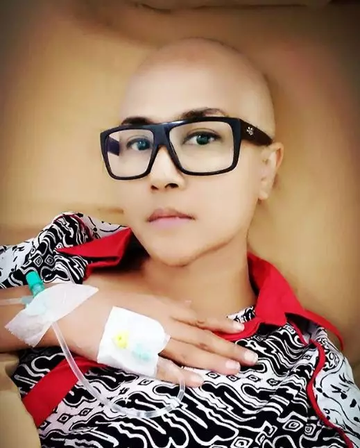 seleb kelenjar getah bening Istimewa