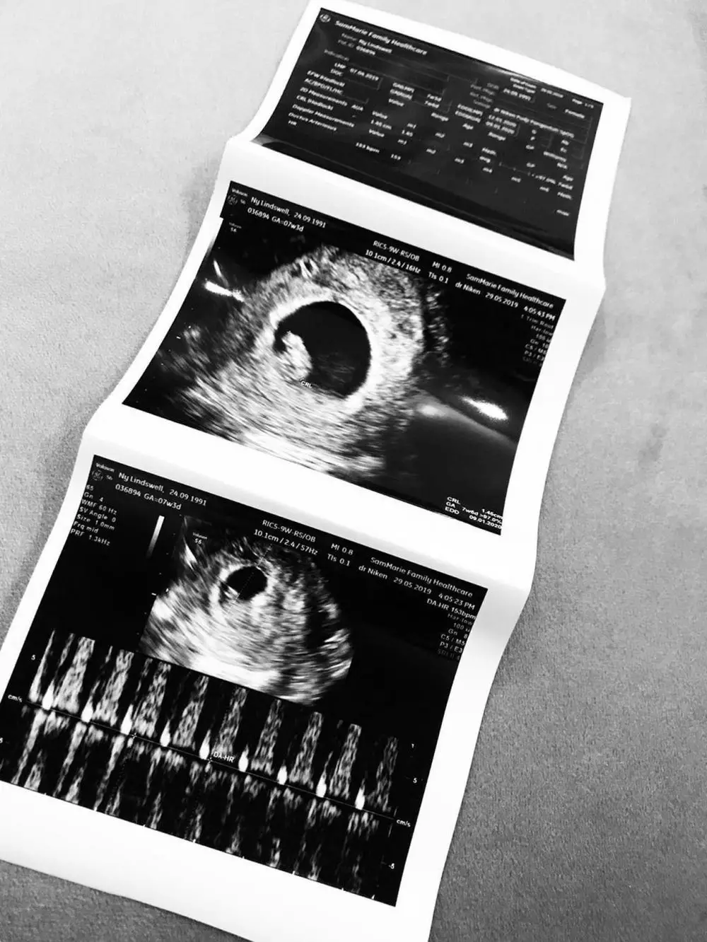 Lindswell Kwok lahirkan anak pertama, ini 6 perjalanan kehamilannya © 2020 instagram.com