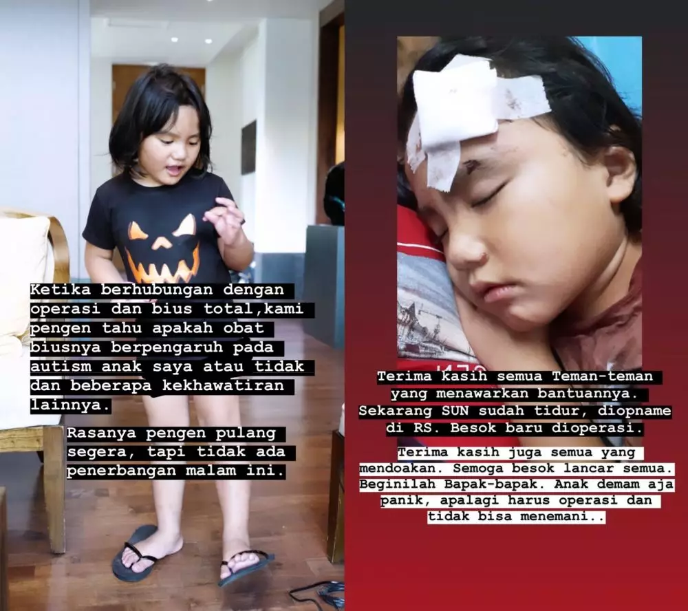 Pelipis anak bungsu Anji sobek hingga harus jalani operasi © 2020 instagram.com