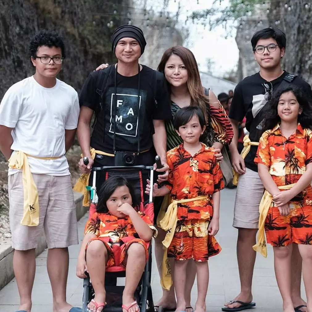 Pelipis anak bungsu Anji sobek hingga harus jalani operasi