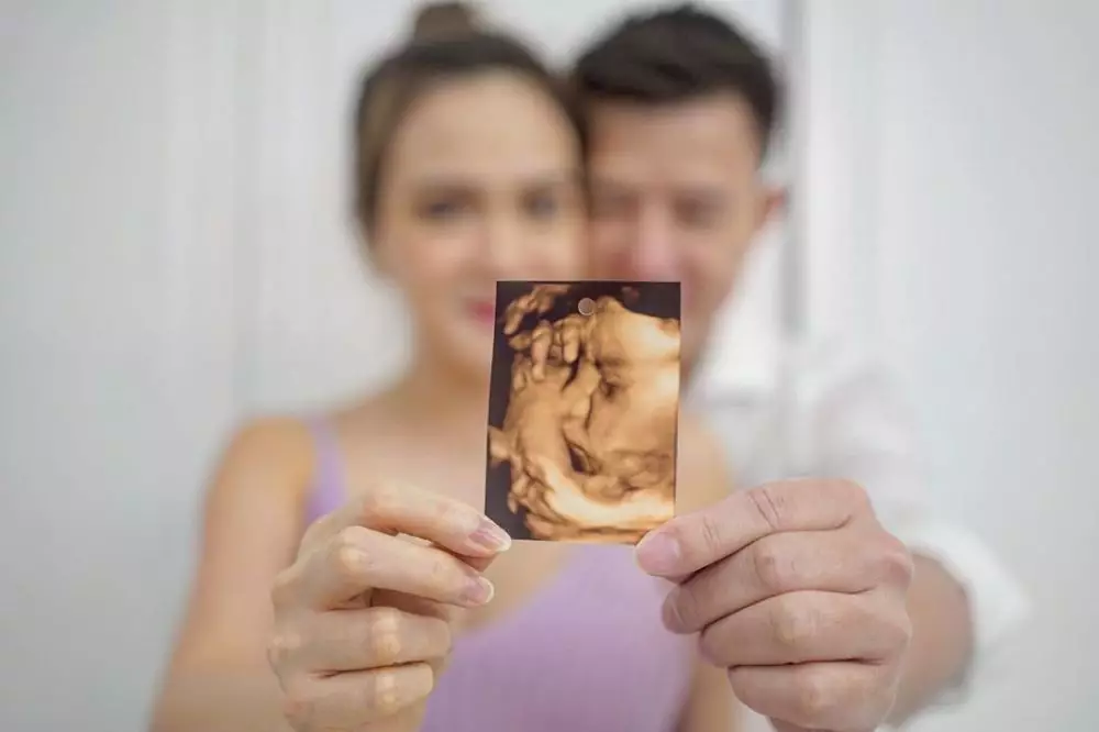 maternity shandy aulia  © 2020 brilio.net