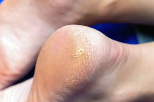 Manfaat serai untuk kecantikan dan kesehatan freepik.com Manfaat serai untuk kecantikan dan kesehatan freepik.com