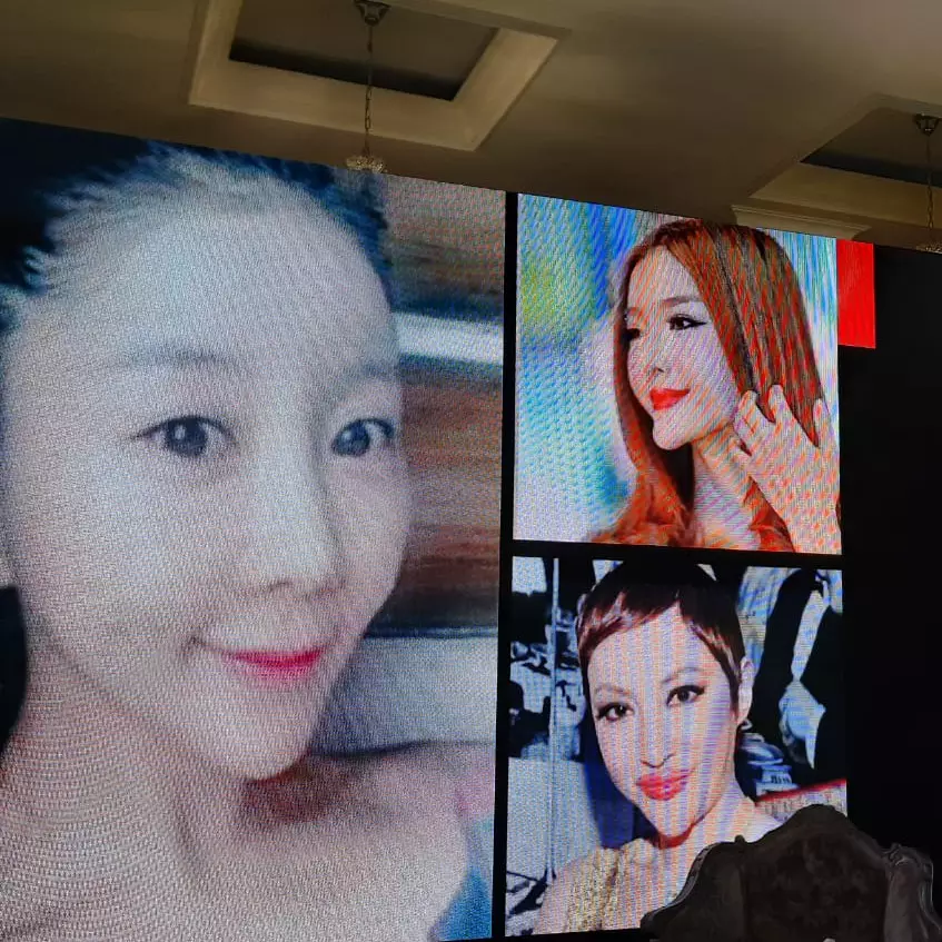 VShape, tren kecantikan terbaru 2020 yang bikin wajah tirus