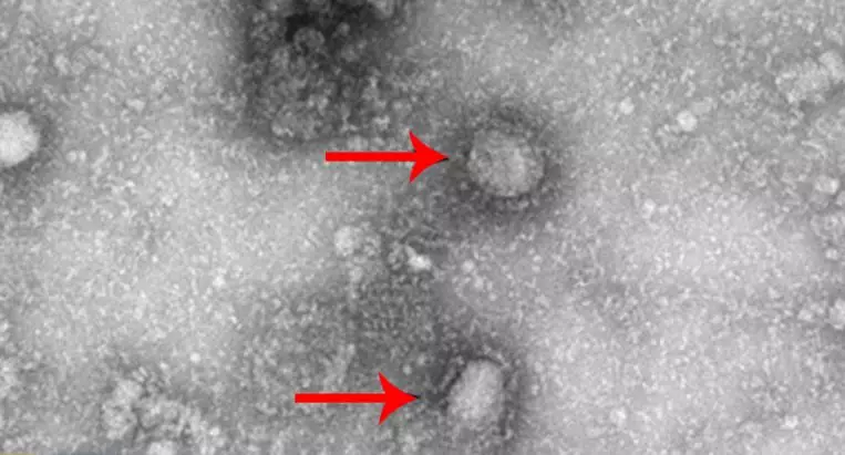 vaksin virus corona berbagai sumber vaksin virus corona berbagai sumber