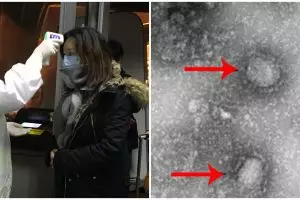 Peneliti Hong Kong klaim vaksin virus Corona telah ditemukan