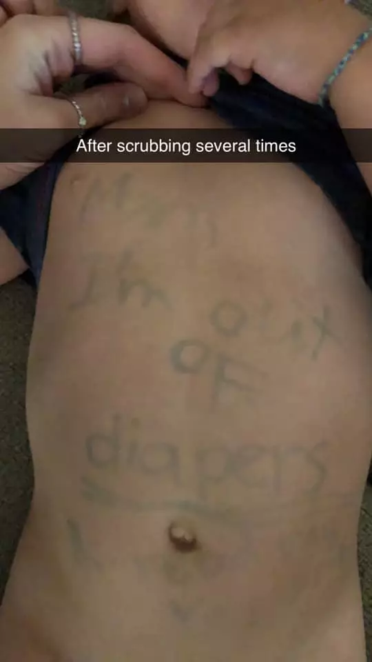 sorang ibu temukan peringatan diperut putranya facebook