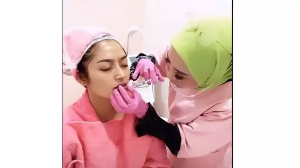 Siti Badriah filler bibir  Instagram 