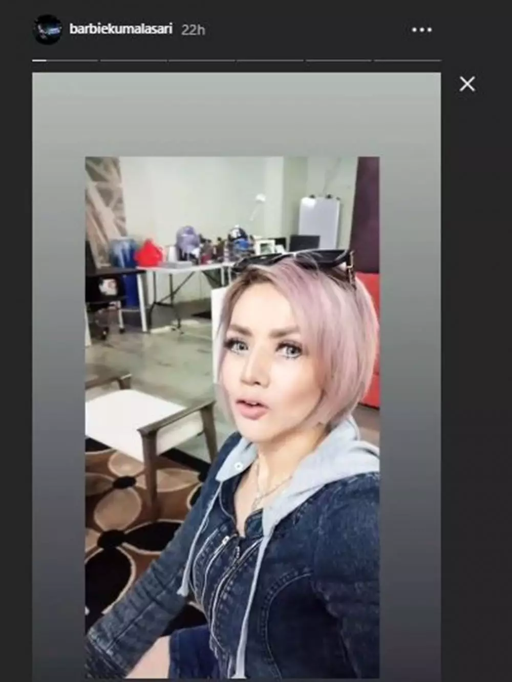 Barbie operasi hidung  Instagram  Barbie operasi hidung  Instagram