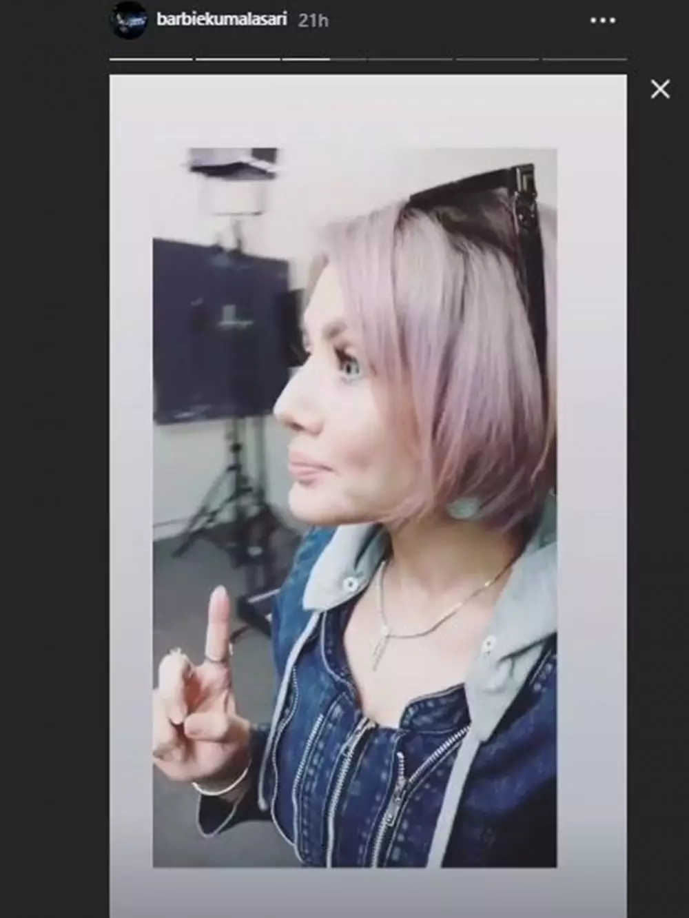 Barbie operasi hidung  Instagram  Barbie operasi hidung  Instagram