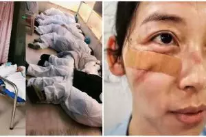 10 Potret kerja keras perawat dan dokter di Wuhan, totalitas