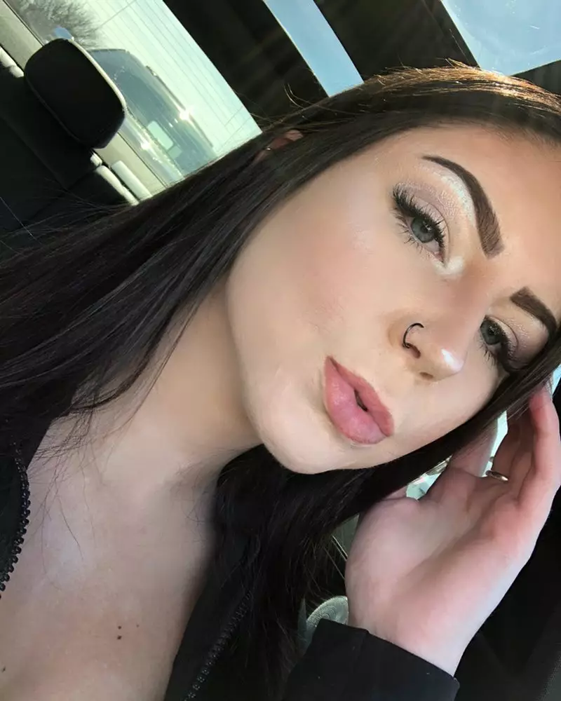 Kisah wanita alami luka bakar Instagram/@delaneyrose.realty Kisah wanita alami luka bakar Instagram/@delaneyrose.realty