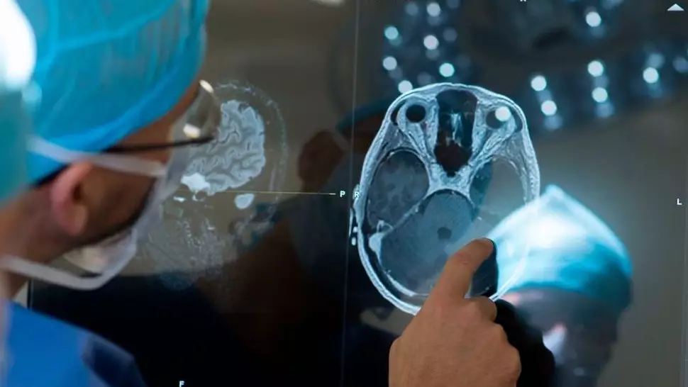 operasi otak x biola berbagai sumber