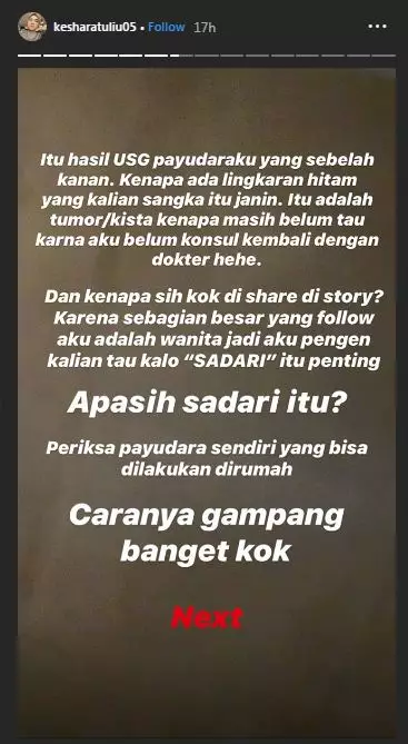 Kesha Ratuliu unggah hasil USG Instagram/@kesharatuliu05