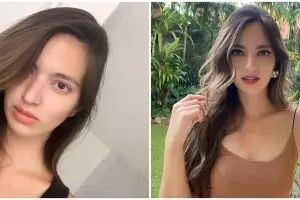 Jika Nia Ramadhani ditawari oplas, ini bagian tubuh yang diubah