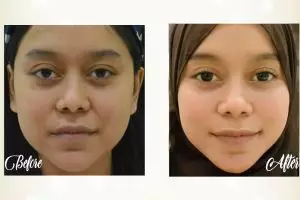 Vintagen, perawatan kecantikan tingkatkan sistem imun tubuh