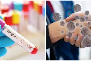 3 Fakta perbedaan Demam Berdarah Dengue & infeksi virus Corona