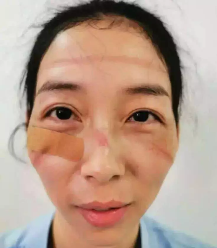 Potret 4 perawat pasien Corona1 Facebook