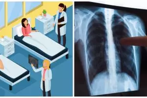 Penjelasan WHO soal penanganan TBC di saat wabah Corona