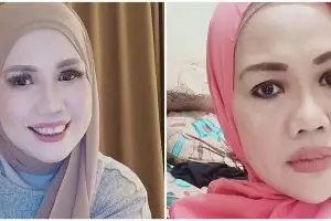 7 Potret Elly Sugigi usai pakai behel, dipuji makin cantik
