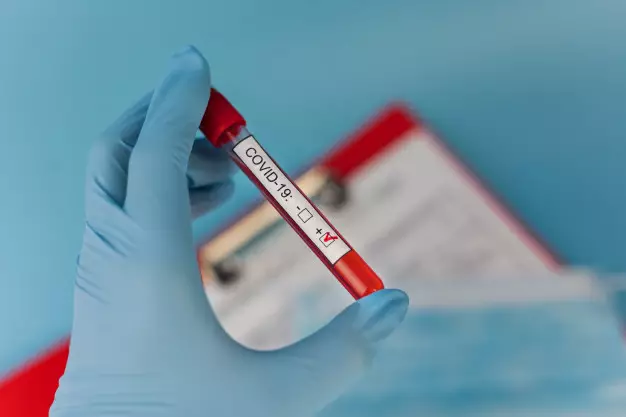 Fakta Rapid Test © 2020 brilio.net