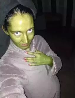 Kulit wanita ini berubah jadi hijau setelah gagal tanning metro.uk Kulit wanita ini berubah jadi hijau setelah gagal tanning metro.uk