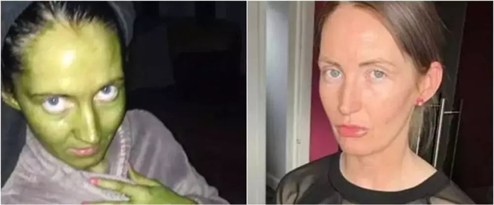 Kulit wanita ini berubah jadi hijau setelah gagal tanning metro.uk Kulit wanita ini berubah jadi hijau setelah gagal tanning metro.uk