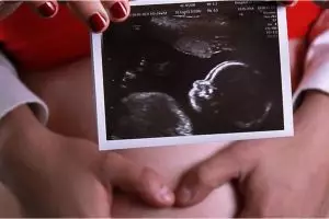 Viral foto hasil USG janin yang acungkan 2 jari, ini sebabnya