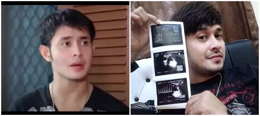 Beda gaya 6 pemain sitkom Abdel & Temon Youtube,Instagram Beda gaya 6 pemain sitkom Abdel & Temon Youtube,Instagram