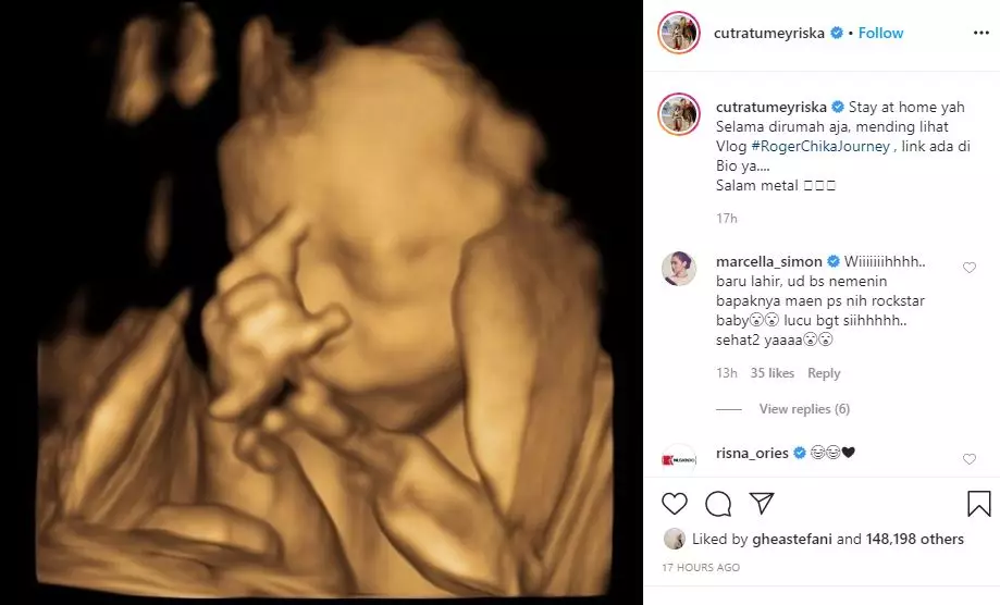 foto usg cut meyriska instagram foto usg cut meyriska instagram