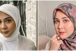 Dibully karena jerawatan, ini respons menohok Kesha Ratuliu