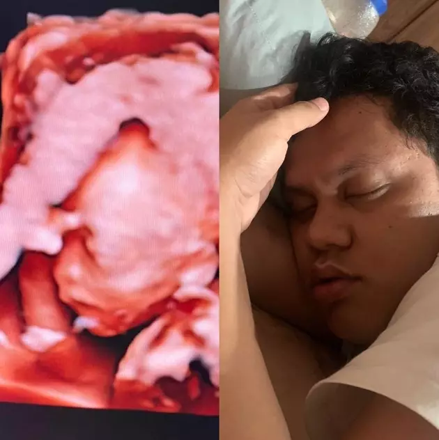 usg seleb © 2020 brilio.net