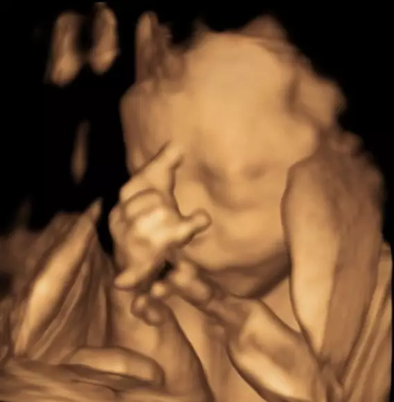 usg seleb © 2020 brilio.net