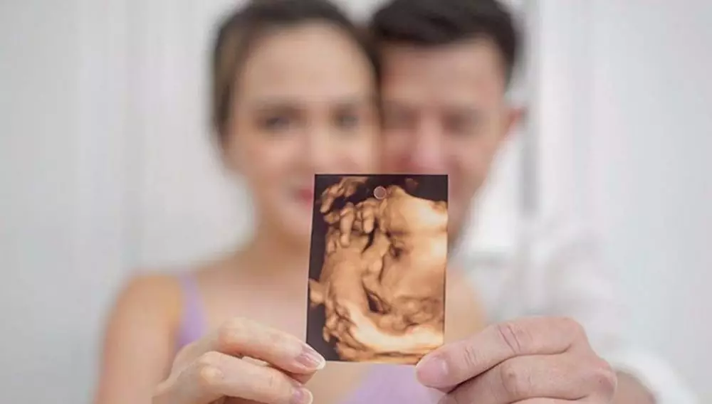 usg seleb © 2020 brilio.net