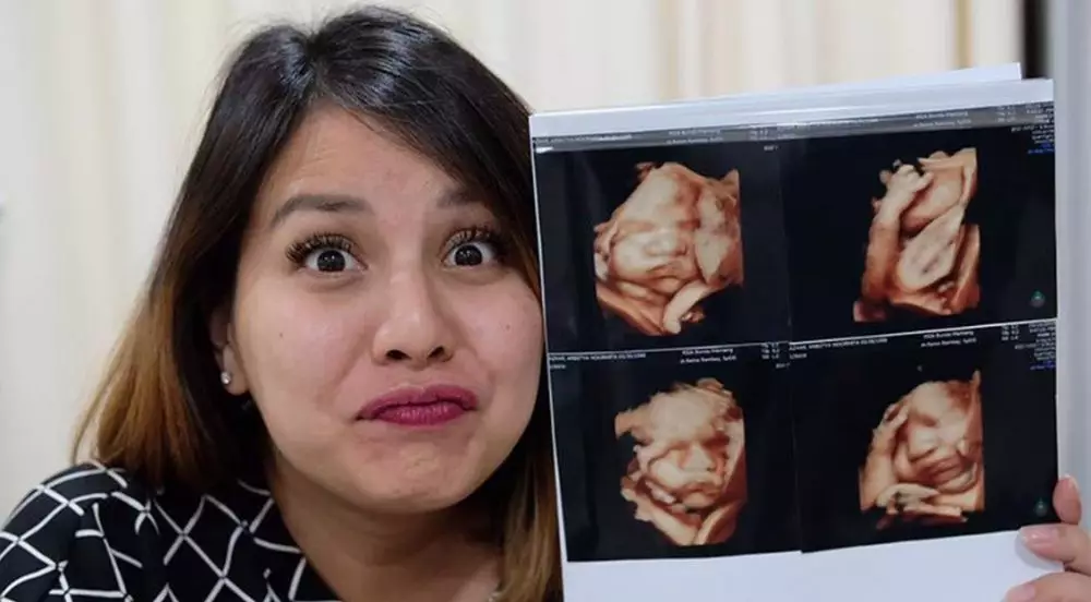 usg seleb © 2020 brilio.net